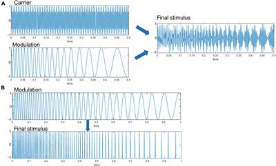 Diagnosing awareness in disorders of consciousness with gamma-band auditory responses
